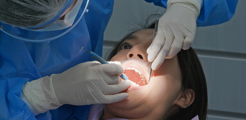 The Benefits of a Root Canal Therapy