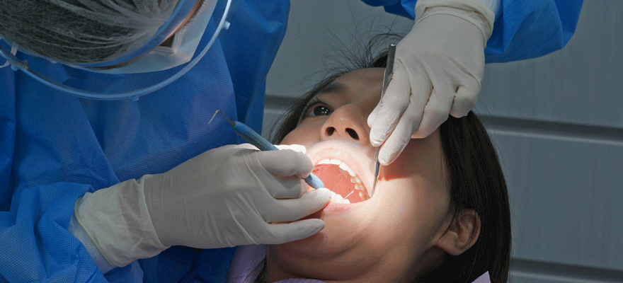 The Benefits of a Root Canal Therapy