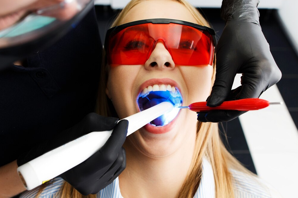 Teeth Whitening in Brampton