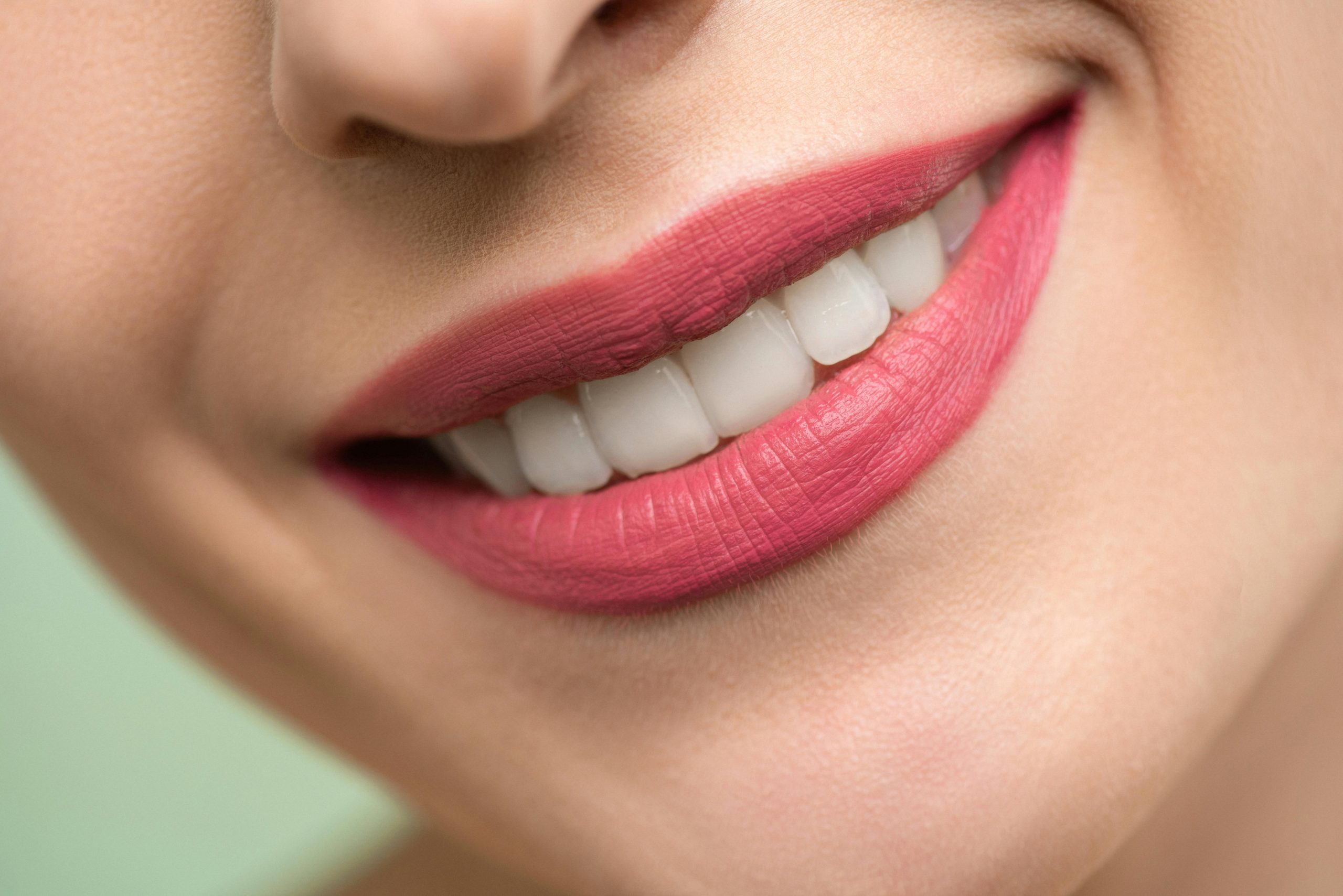 Where to Get Teeth Whitening in Brampton